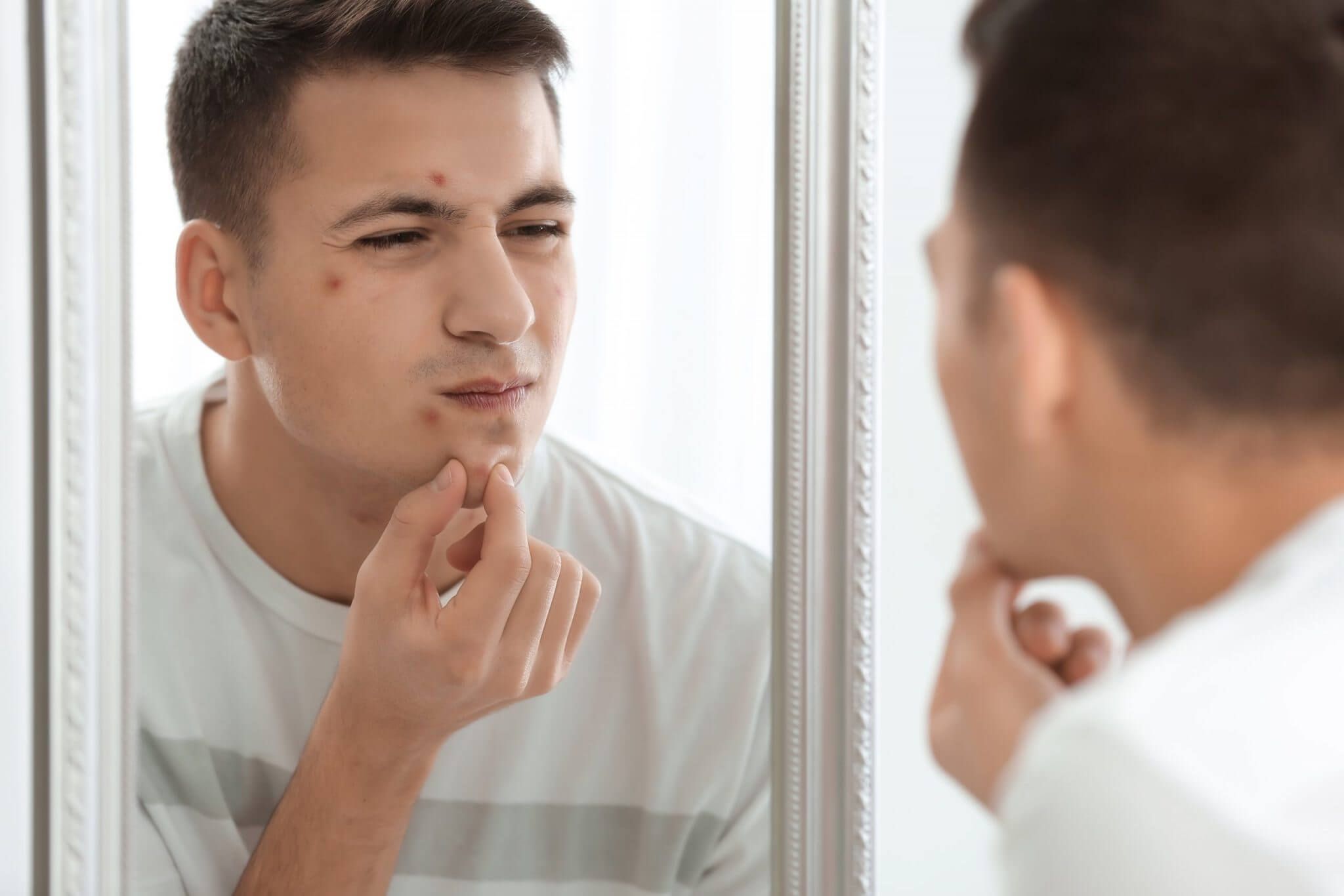 去粉刺的小撇步—哪一種真正有效？