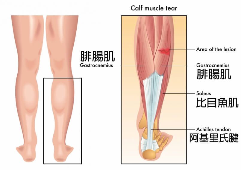 小腿肌肉由甚麼組成?