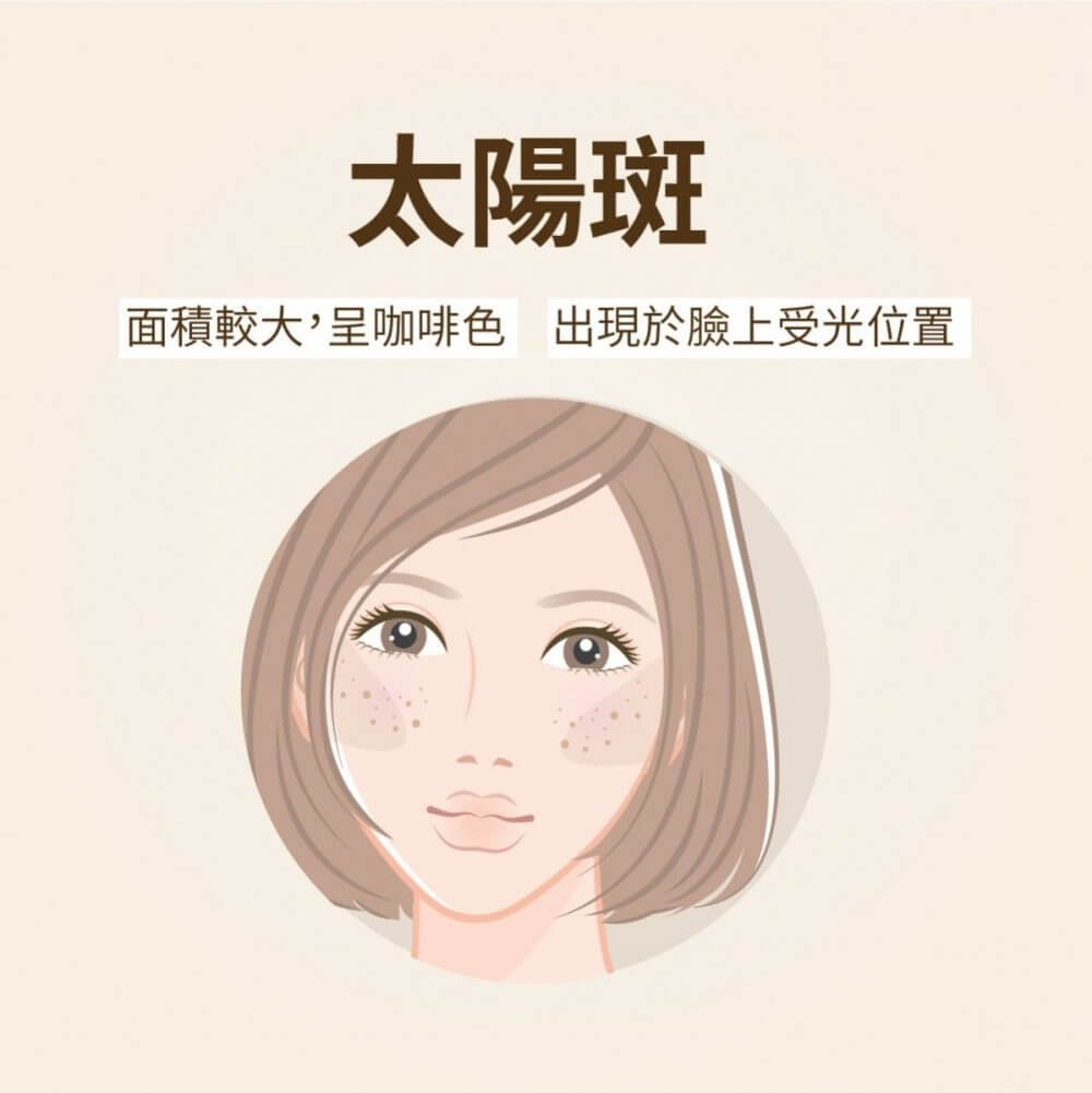 太陽斑是甚麼?
