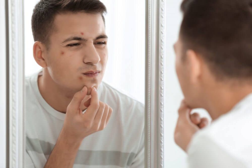 壓力瘡位置有甚麼原因？壓力瘡還會在身體出現