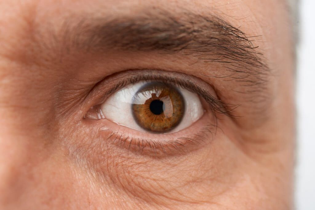 要怎樣預防眼下紋?