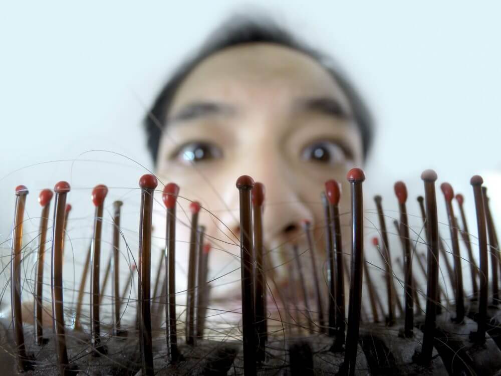 問：年輕男士就不會有脫髮問題？