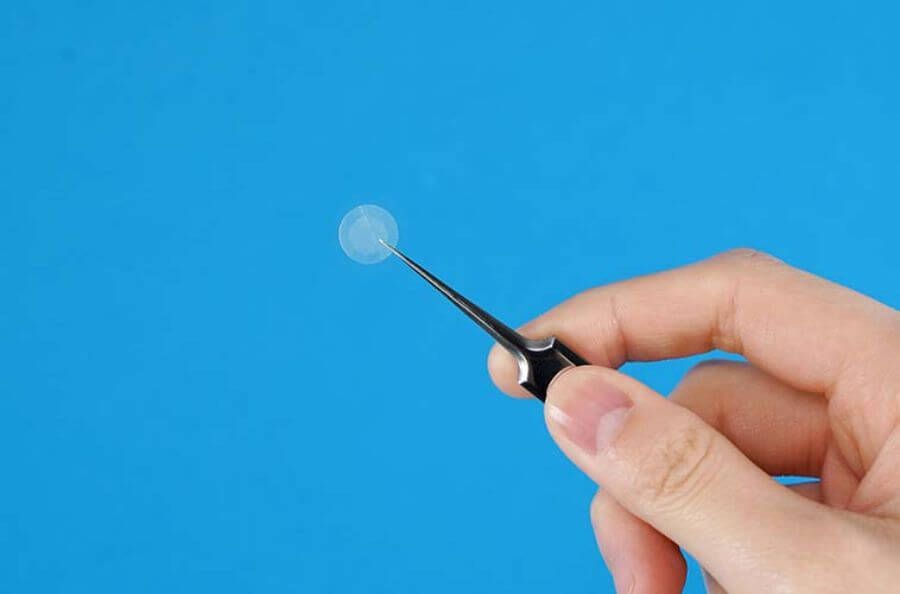 暗瘡貼可以用在甚麼暗瘡種類之上?