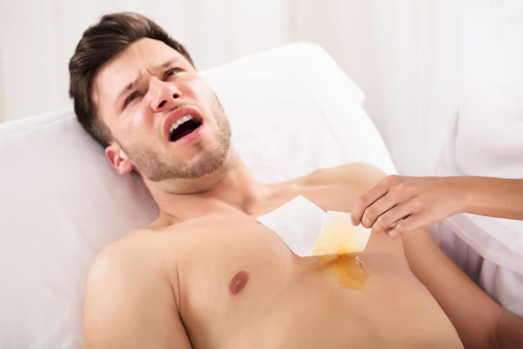 激光永久脫毛的迷思