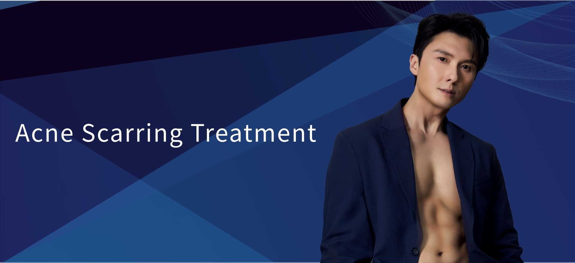 Acne Scarring Treatment